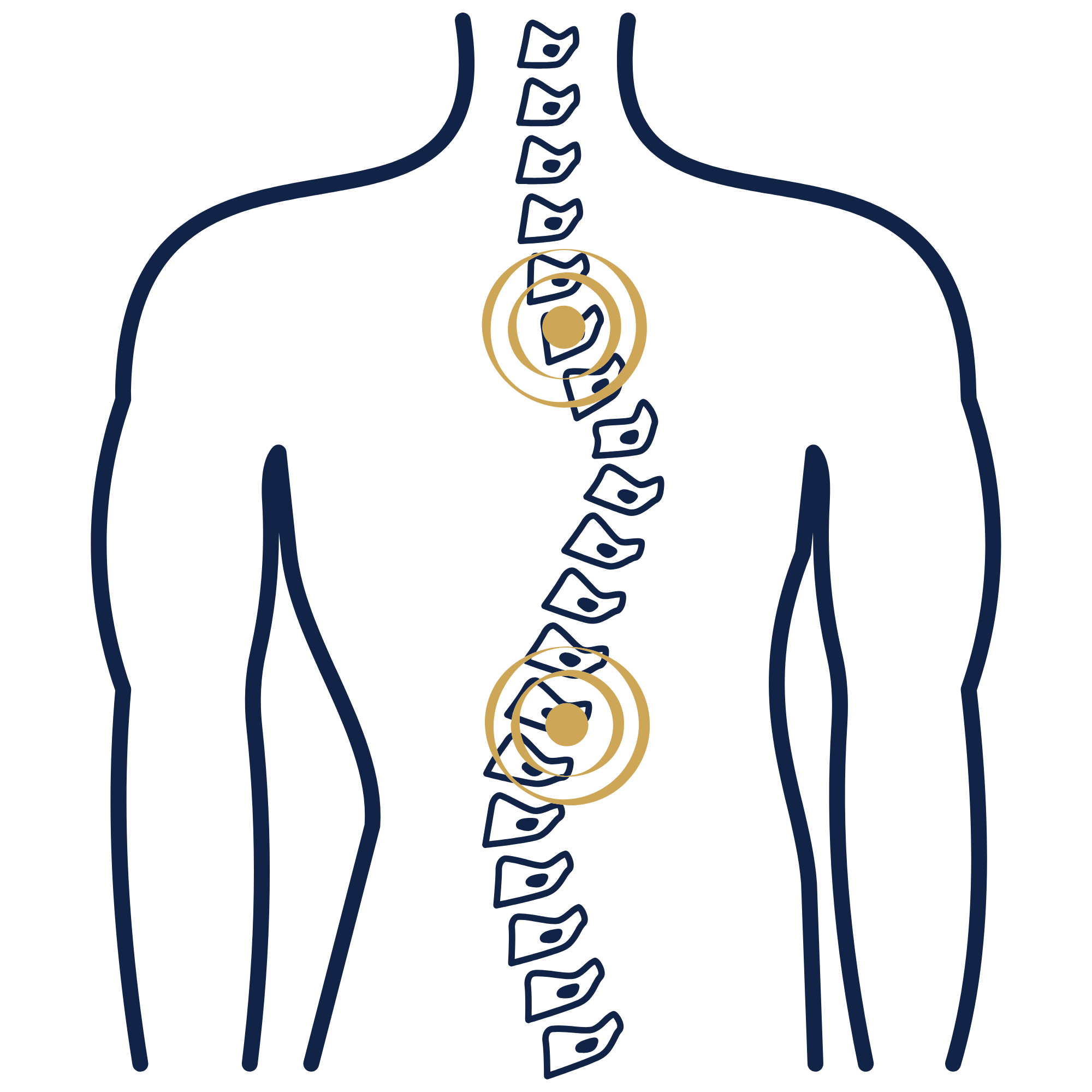 Scoliosis